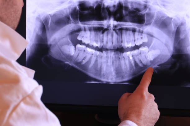 Best Emergency Root Canal Treatment in Oquawka, IL