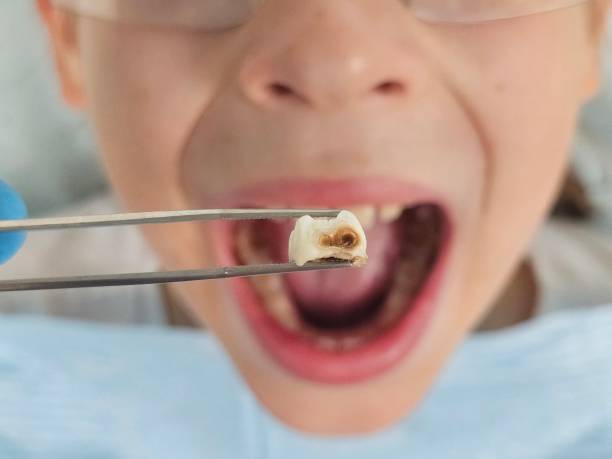 Best Cosmetic Emergency Dentistry in Oquawka, IL