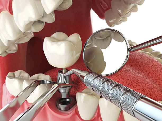 Best Weekend Emergency Dentist in Oquawka, IL